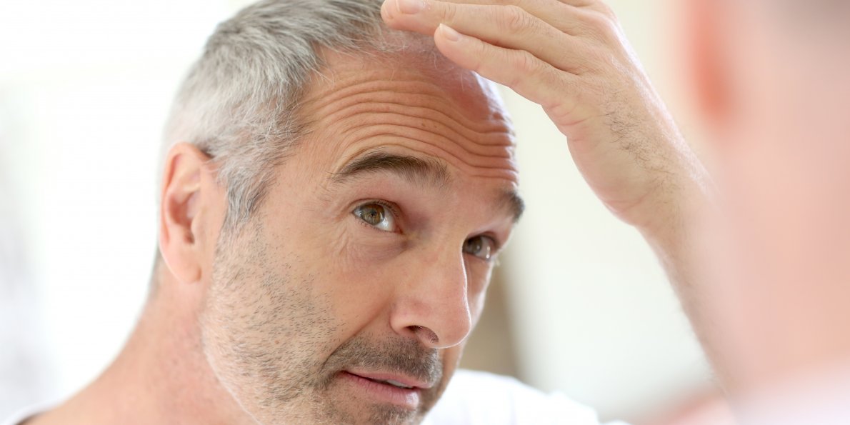 how to regrow hair in baldness